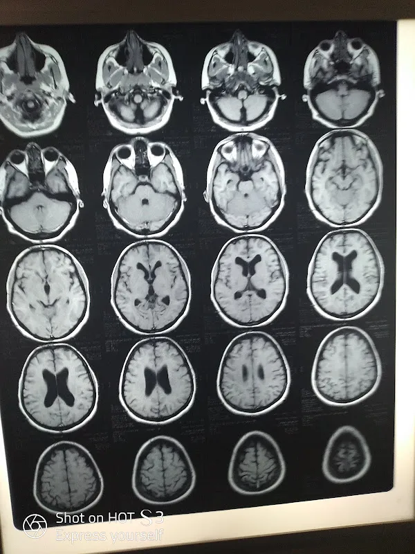 دكتور عبدالرحمن شوقي إستشاري أمراض المخ والأعصاب والطب النفسي وعلاج الألم