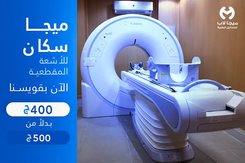مركز ميجا للاشعه والتحاليل الطبيه